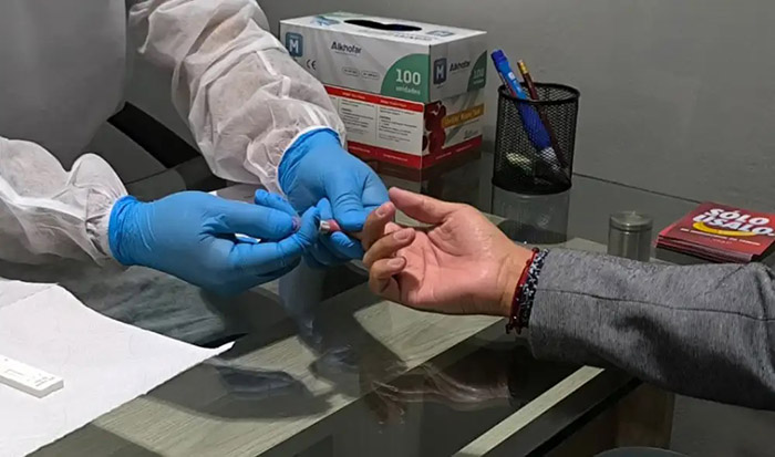 Cusco: Geresa reporta 193 nuevos casos de VIH y alerta contagio en población joven masculina